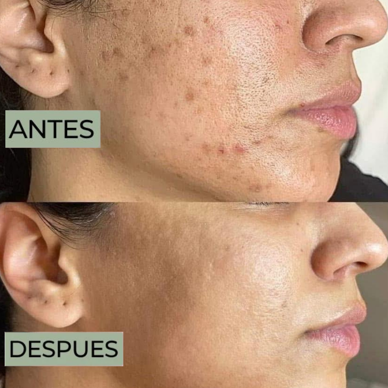 Paquete Glow Routine – Limpieza + Renovación Total