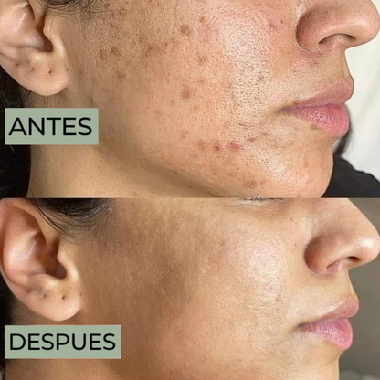 Paquete Glow Routine – Limpieza + Renovación Total