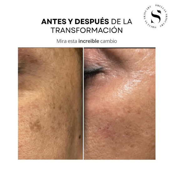 Paquete Glow Routine – Limpieza + Renovación Total